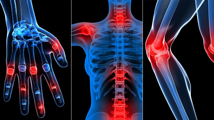 What Causes Joint Pain and When to Worry